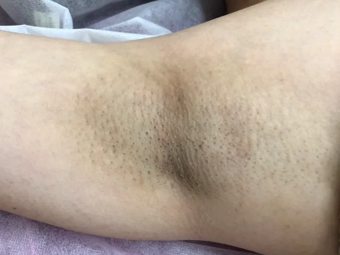 ニオイに関して周囲から指摘を受けて